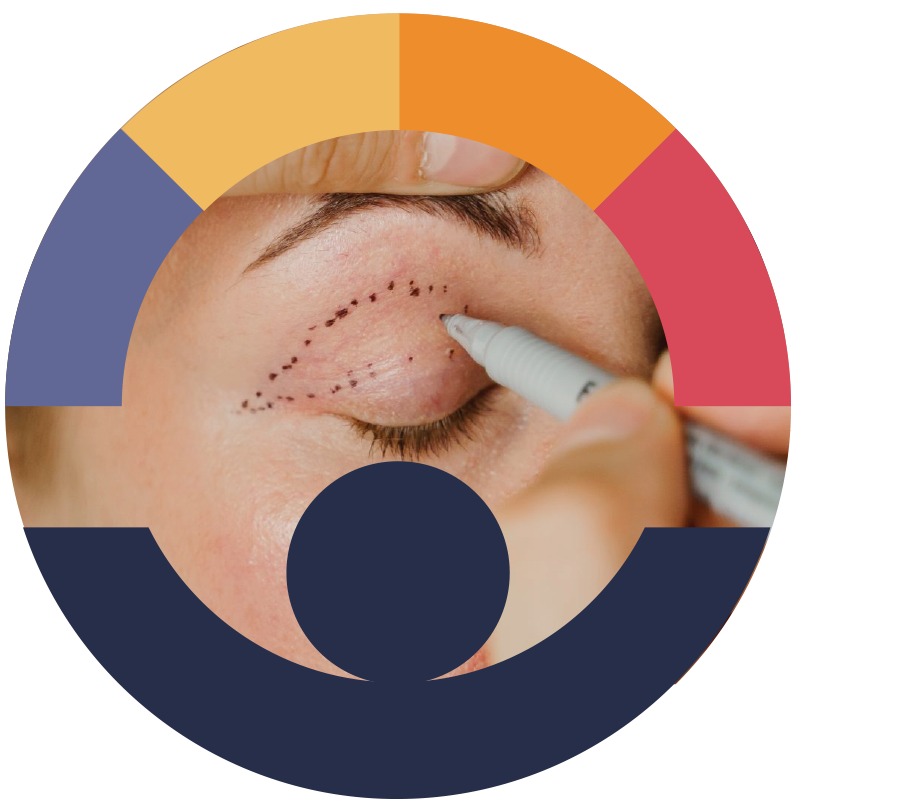 oculoplastica